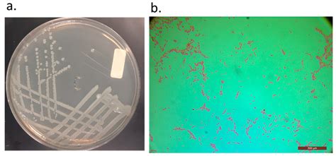 Serratia Marcescens Colony Morphology