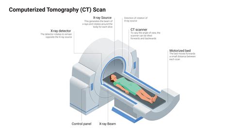 Computerized Tomography (CT) Scan | GI Update