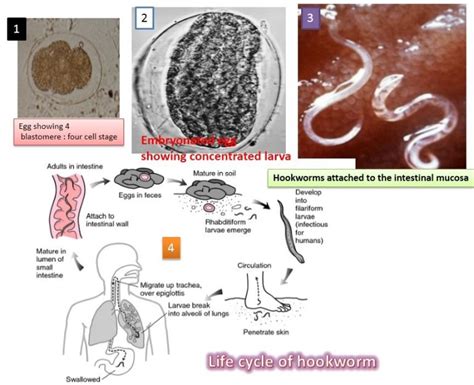 Hookworm: Introduction, Morphology, life cycle, mode of infection