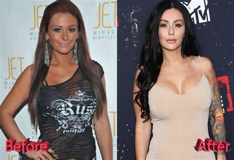 Jwoww Plastic Surgery: Thumbs Up Or Thumbs Down?