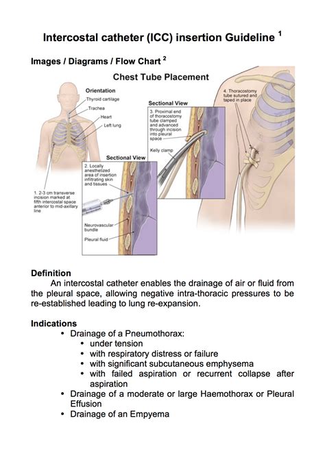 Chest Drain Insertion Guideline - Charlie's ED