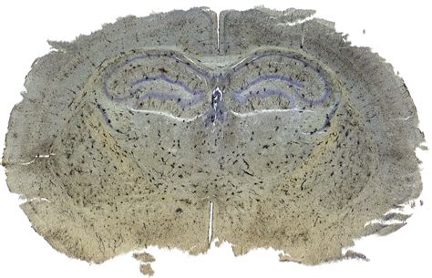 Brain Tissue Sample - Meyer Instruments