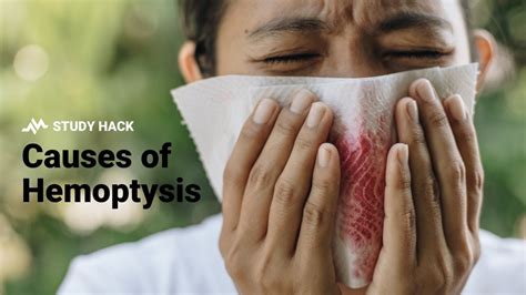 Causes of Hemoptysis (Coughing Blood) - YouTube