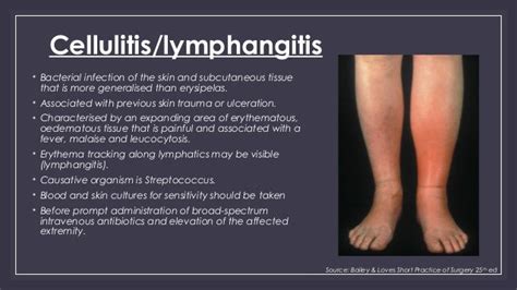 cellulitis on foot - pictures, photos