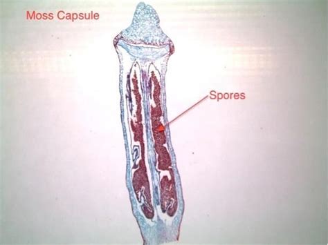 moss sporophyte capsule, c.s. | Vascular plant, Spore, Moss