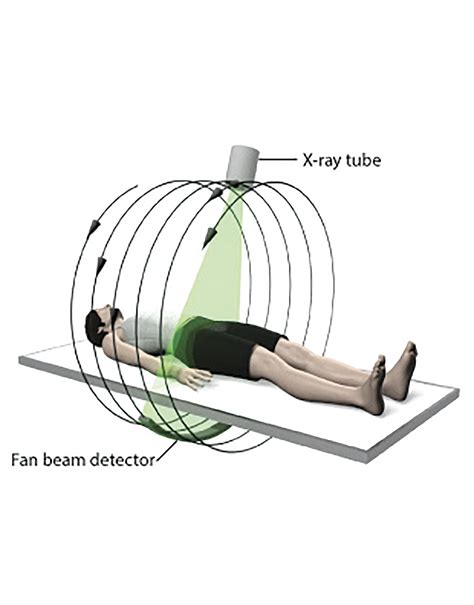 What is Cone Beam CT? - Orthopaedic Product News