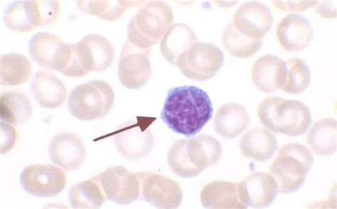 What is the Difference Between Monocytes and Lymphocytes - Pediaa.Com