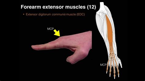 Forearm extensor muscles - YouTube