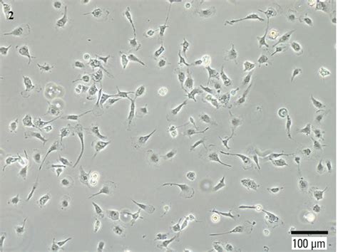 Immortalized Human Brain Microglia Cells | Neurons, Human brain, Motor neuron