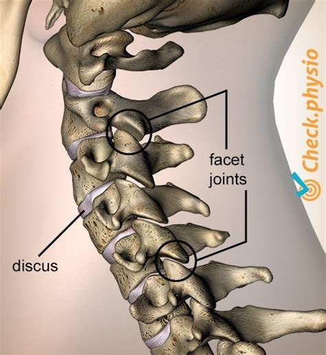 Cervical posture syndrome | Physio Check