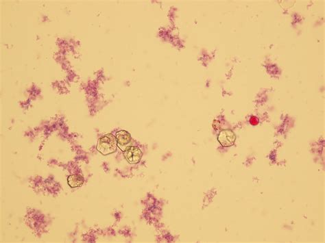 Microscopic Analysis of Urine | Faculty of Medicine, Masaryk University