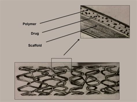 Components of a drug-eluting stent. Note: The metal scaffold is coated ...