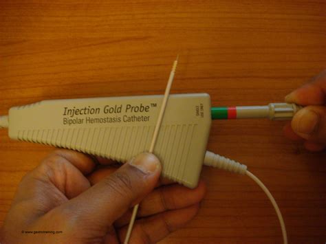 Gastroenterology Education and CPD for trainees and specialists » Use of Gold probe