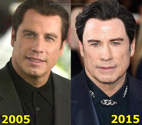 John Travolta Plastic Surgery Fact or Rumor - Plastic Surgery Hits