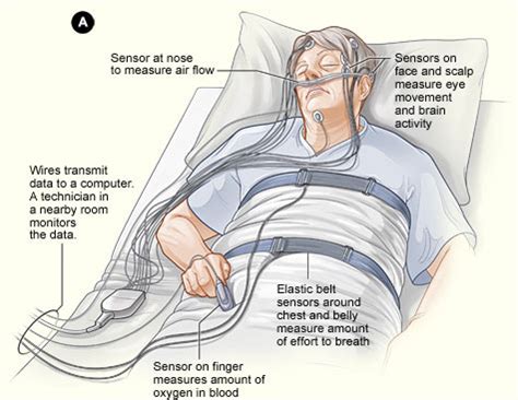 The Polysomnogram Test for Sleep Apnea