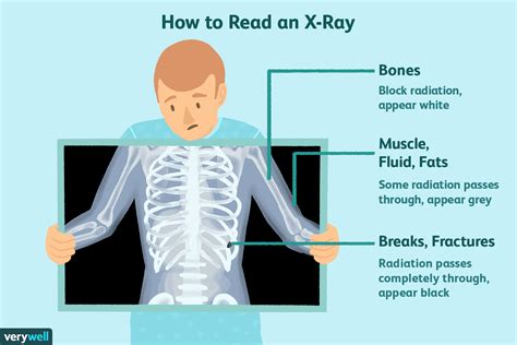 X-Rays: Uses, Procedure, Results