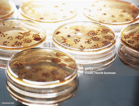 Microaerophilic Organisms Cultivated In Agar In Petri Dishes Closeup ...