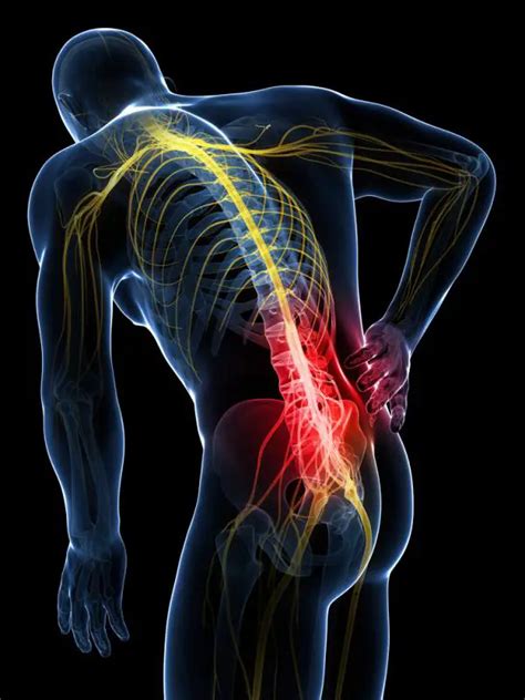 Que es discartrosis lumbar. Síntomas y tratamientos - Columna Vertebral