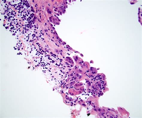 Mesothelium Histology