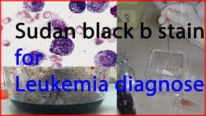 Sudan Black B Stain - Purpose, Principle, Procedure, Preparation, Protocol and Clinical ...