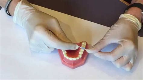 How to replace your orthodontic separators (aka. spacers) at home. - YouTube