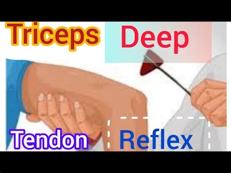 Triceps Reflex - YouTube