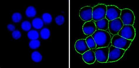 EpCAM Antibody (MA5-12436)