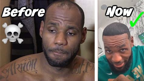 LEBRON JAMES' HAIRLINE HAS BEEN RESTORED! - YouTube