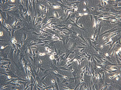 Primary Human Hepatic Stellate Cells | ax3760-1 | Axol Bioscience