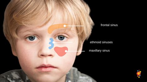 Orbital fractures - Don't Forget the Bubbles