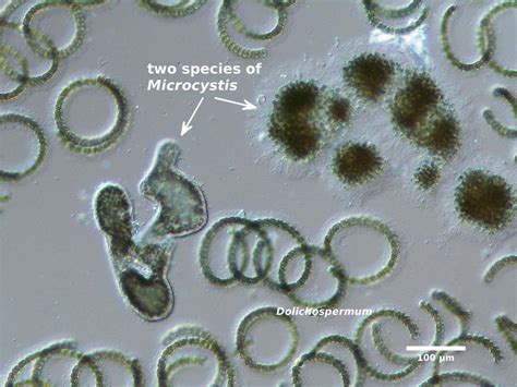 Microcystis (cyanoScope) · iNaturalist