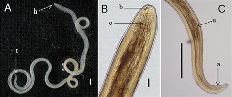 Subconjunctival Loa loa worm - International Journal of Infectious Diseases