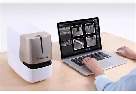 Fussen Dentalink Dental Digital intraoral Imaging Plate X ray Dental Scanner