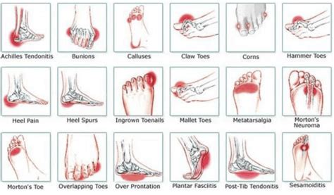 Foot pain - All you need to know | Causes, Treatments & Symptoms