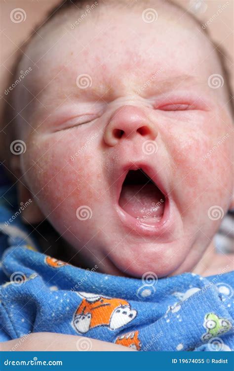 Yawning Baby stock image. Image of color, human, babies - 19674055