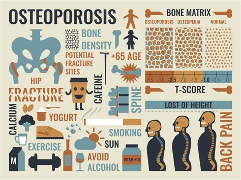 Osteoporosis Awareness and Prevention Month – May 2016 - Kim Burnett