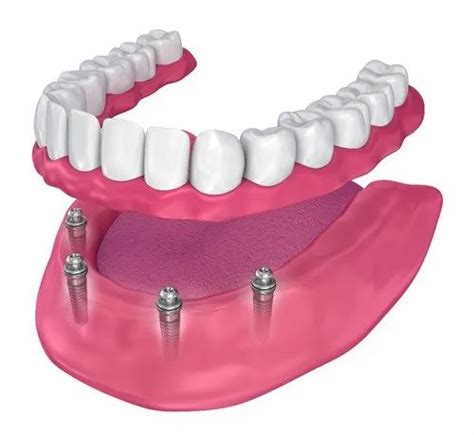 Fixed Prosthetic Dentures at best price in Bengaluru | ID: 21133117488