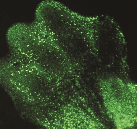 The many routes to cell death | Stanford Medicine