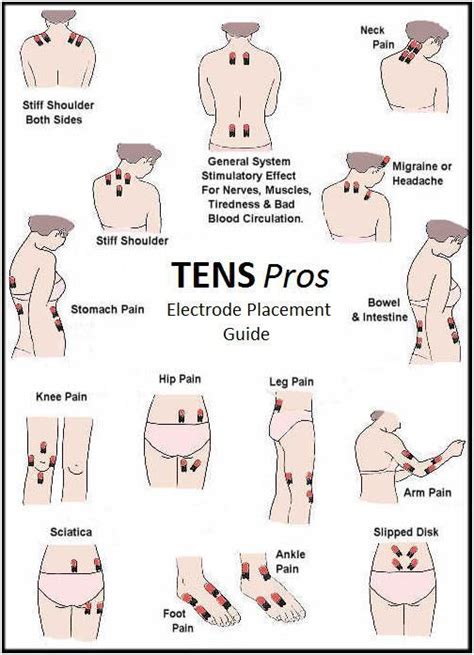 Tens Electrode Placement: What You Should Know | Tens unit therapy ...