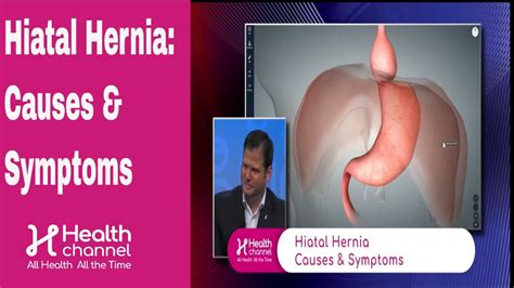 Hiatal Hernia: Causes & Symptoms - YouTube