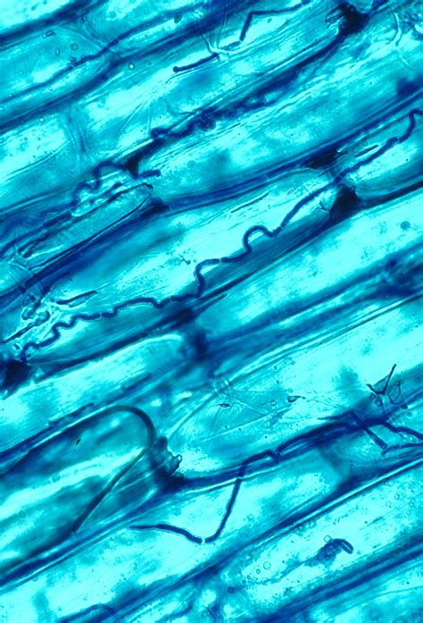 Life With Endophytic Fungi — In Defense of Plants