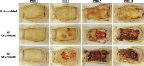 Formation of Pseudomonas aeruginosa Biofilms in Full-thickness Scald ...