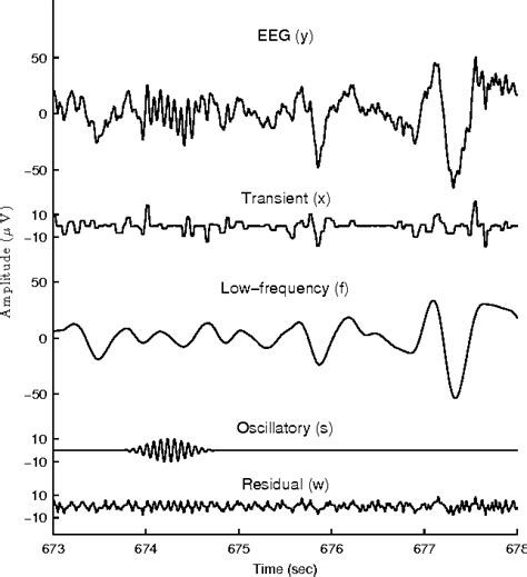 Figure 1 from Detection of K-complexes and sleep spindles (DETOKS ...