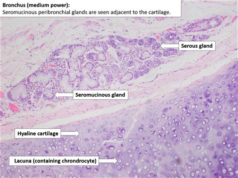 Bronchus – Normal Histology – NUS Pathweb :: NUS Pathweb