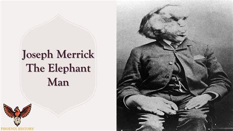 The Elephant Man Biography Story