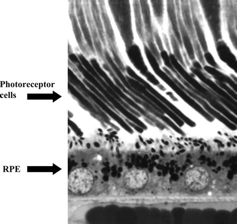 How to keep photoreceptors alive | PNAS