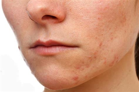 Types of Skin Problems on Face - Top 10 List - Skin Care Geeks