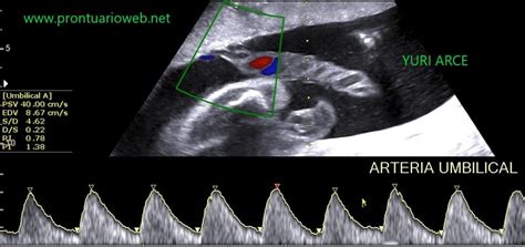 Doppler em Obstetrícia ⋆ PRONTUARIOWEB