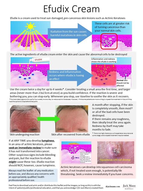 Efudix leaflet — Dr Jack Mann