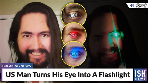 US Man Turns His Eye Into A Flashlight | ISH News - YouTube